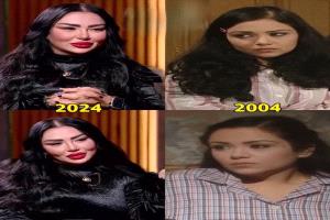 فنانة مصرية تثير الجدل بتغيير ملامحها.. وتردّ على التنمّر